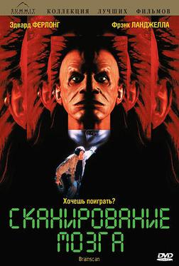 Сканирование мозга Сканирование мозга